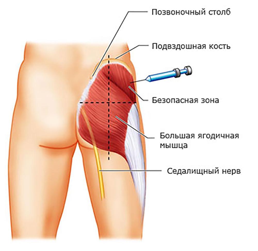 На самом деле все не сложно! А вы знаете под каким углом делать инъекции? Наглядная простая инструкция