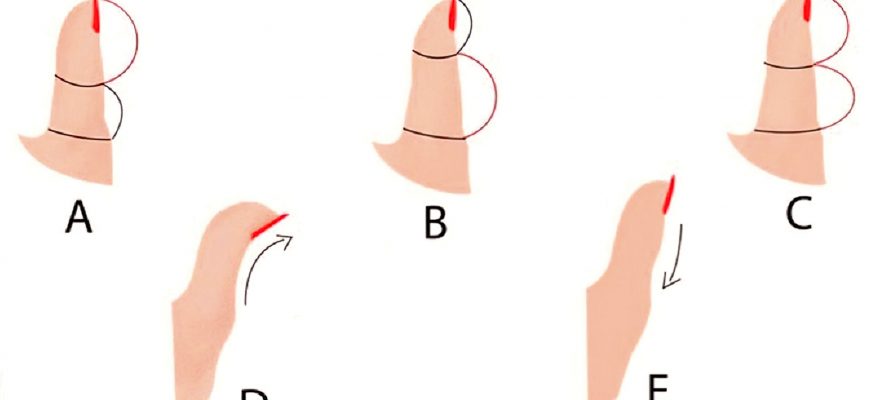 По форме большого пальца можно все рассказать о характере