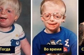 Родители бросили сына, потому что он был некрасивым, но это всего лишь часть истории