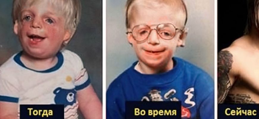 Родители бросили сына, потому что он был некрасивым, но это всего лишь часть истории