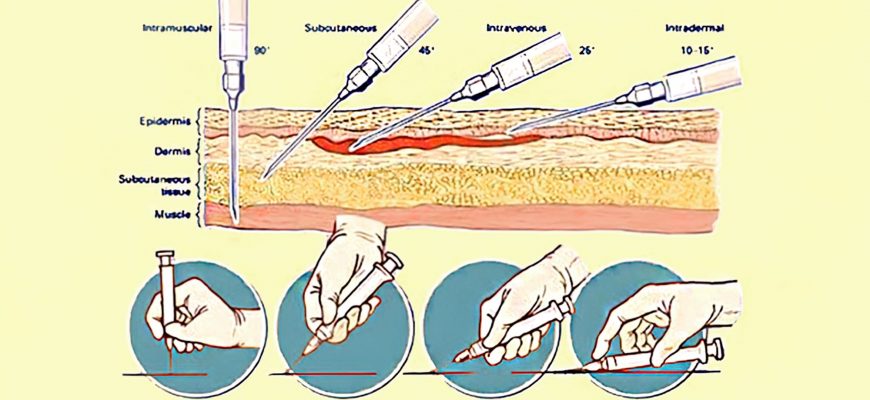 На самом деле все не сложно! А вы знаете под каким углом делать инъекции? Наглядная простая инструкция