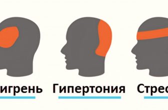 За 5 минут могу избавиться от головной боли без таблеток? Это проще простого!