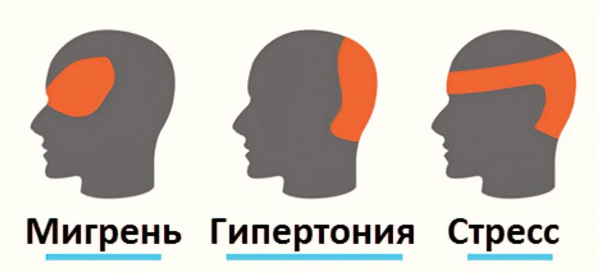 За 5 минут могу избавиться от головной боли без таблеток? Это проще простого!