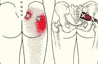 Эти 2 простых трюка быстро разблокируют седалищный нерв и облегчат боль сразу!