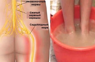 Простой дешевый способ, который эффективно вылечит воспаление седалищного нерва навсегда!