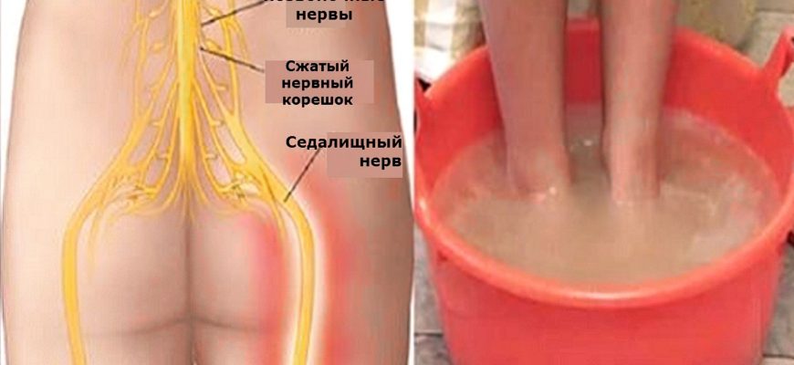 Простой дешевый способ, который эффективно вылечит воспаление седалищного нерва навсегда!