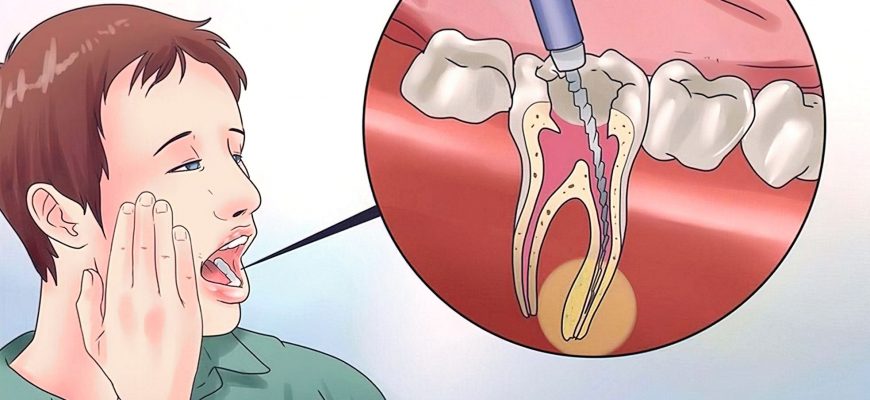 Почему стоматологи скрывают это от нас? Эффективные средства для избавления от зубной боли