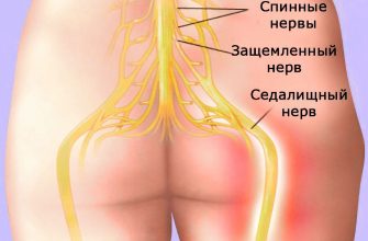 Так вот чем снять боль при защемлении нервов!