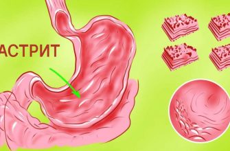 На самом деле избавиться от гастрита, изжоги и язвы можно всего за 7 дней, если знать эти 5 рецептов